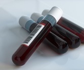 독일 연구팀, 코로나19 중환자 생사 예측 가능한 혈액 검사 개발