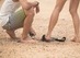 당뇨 환자, 여름철 샌들·슬리퍼 신다가 발에 궤양 생길 수도