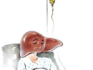 간경화증, 뇌졸중 위험 높인다