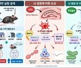 사과껍질 속 '우르솔산', 뇌 염증 줄이고 기억력 지킨다
