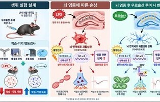 사과껍질 속 '우르솔산', 뇌 염증 줄이고 기억력 지킨다