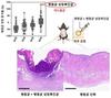 마스크 여드름, 항생제 없이 서식하는 세균으로 막는다