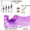 마스크 여드름, 항생제 없이 서식하는 세균으로 막는다