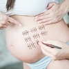 “가소제 프탈레이트, 조산 위험↑”