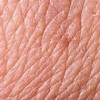 가을철 무너진 피부 탄력, 리프팅 시술로 개선 가능