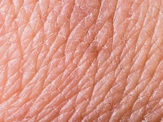 가을철 무너진 피부 탄력, 리프팅 시술로 개선 가능