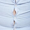 “비만, 치매 유사 뇌 변화와 연관 있다”