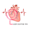스트레스, 심부전 위험↑