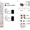 부산대·고신대 연구팀, 암 사망률 1위 폐암 항암제 내성 극복 실마리 찾았다