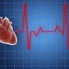 “뇌경색 생존자 20%, 미진단 심방세동”