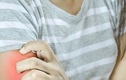 처서 지나도 물러가지 않는 무더위, 여름 불청객 ‘땀띠’ 관리법은