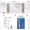 지방세포 줄기세포 단계로 되돌려 비만 막는다