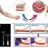 KAIST 정재웅‧정원일 교수 연구팀, 혈관‧조직 손상 막는 주삿바늘 개발