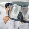 X레이·CT 너무 많이 찍나…한해 의료방사선 검사, 선진국의 7배