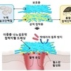 홍합+누에고치 단백질로 지혈제 개발…연구진 