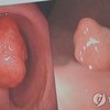 암환자 300만명 정보로 '암데이터' 구축…